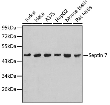 Septin 7 Rabbit Polyclonal Antibody
