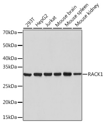 RACK1 Rabbit Monoclonal Antibody