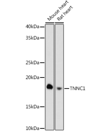 TNNC1 Rabbit Monoclonal Antibody