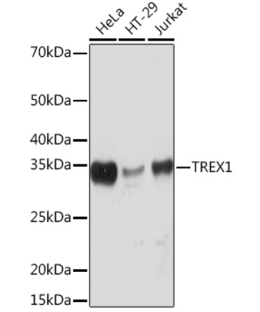 TREX1 Rabbit Monoclonal Antibody