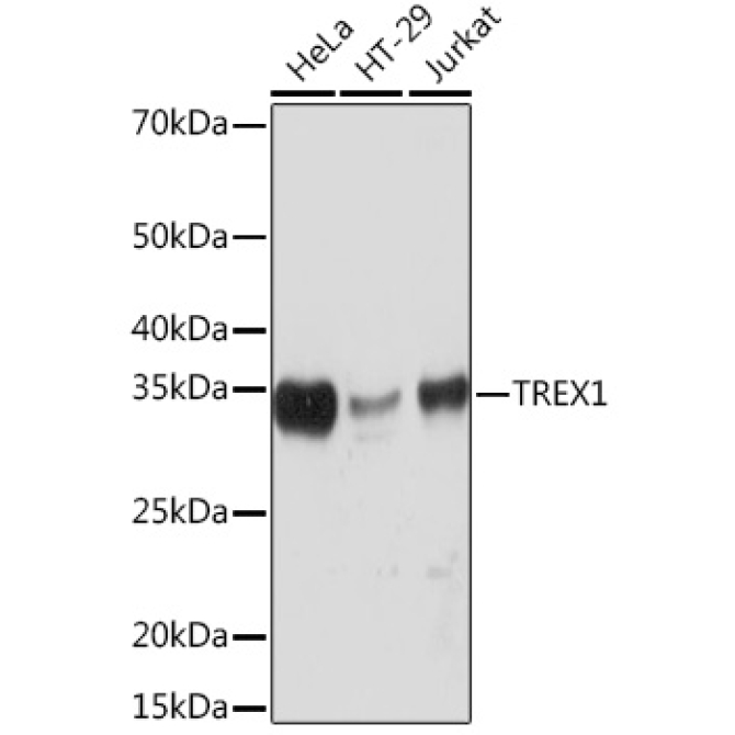 TREX1 Rabbit Monoclonal Antibody