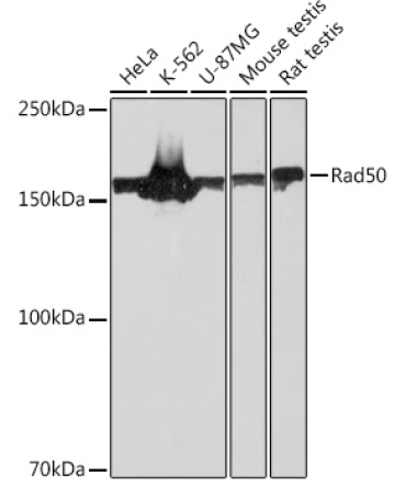 Rad50 Rabbit Monoclonal Antibody