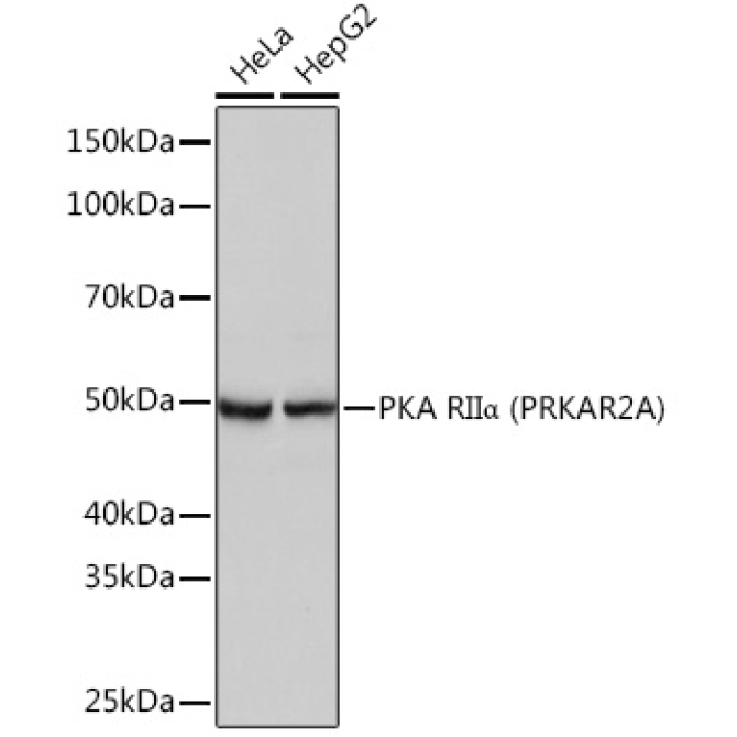 PKA RIIAlpha (PRKAR2A) Rabbit Monoclonal Antibody