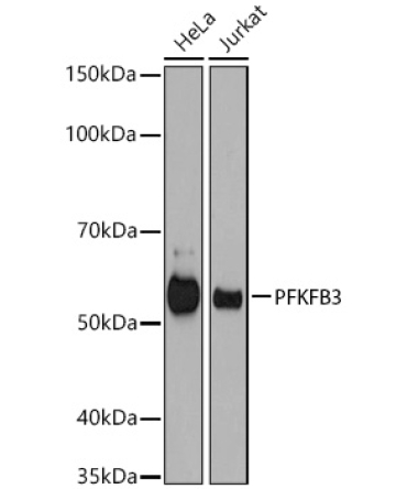 PFKFB3 Rabbit Monoclonal Antibody