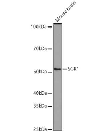 SGK1 Rabbit Monoclonal Antibody