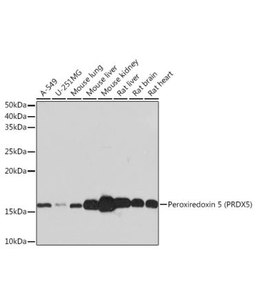 Peroxiredoxin 5 (PRDX5) Rabbit Monoclonal Antibody