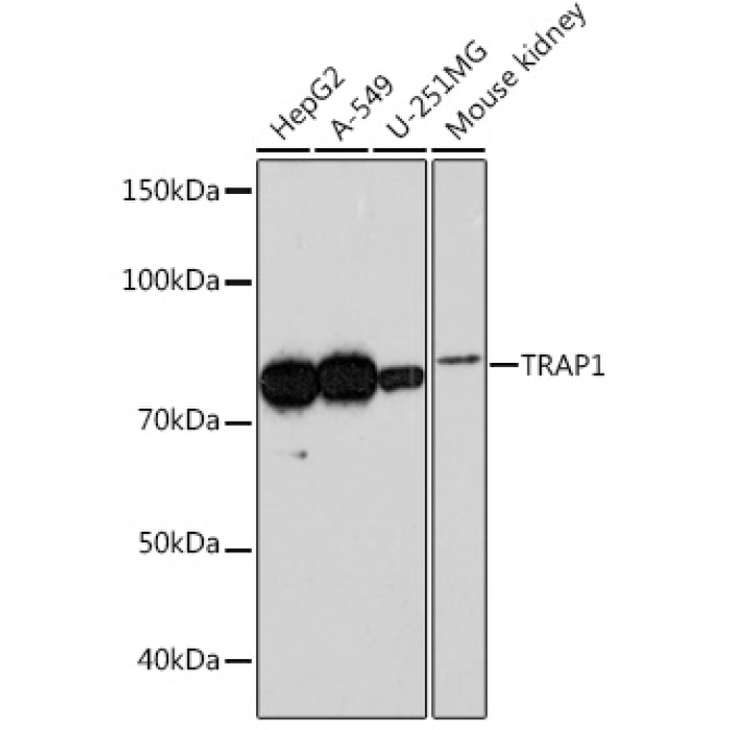 TRAP1 Rabbit Monoclonal Antibody