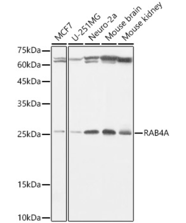 RAB4A Rabbit Monoclonal Antibody