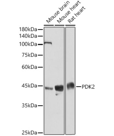 PDK2 Rabbit Polyclonal Antibody