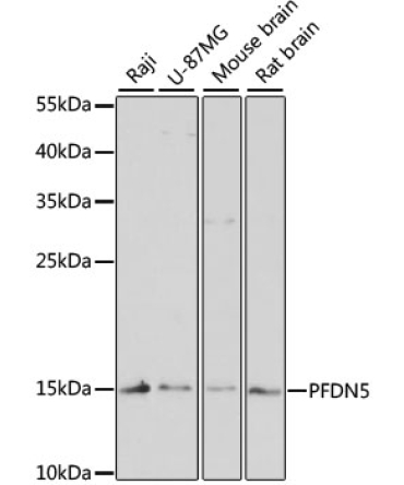 PFDN5 Rabbit Polyclonal Antibody