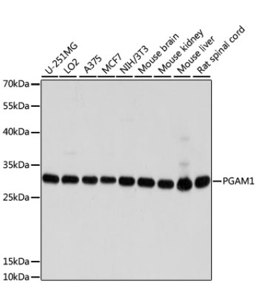 PGAM1 Rabbit Polyclonal Antibody