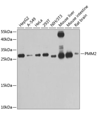 PMM2 Rabbit Polyclonal Antibody
