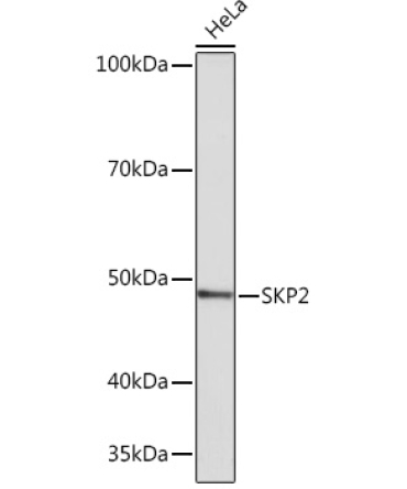 SKP2 Rabbit Monoclonal Antibody