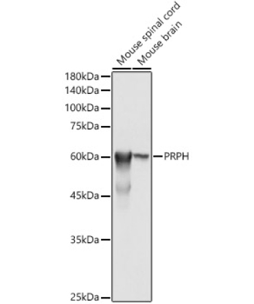 PRPH Rabbit Polyclonal Antibody