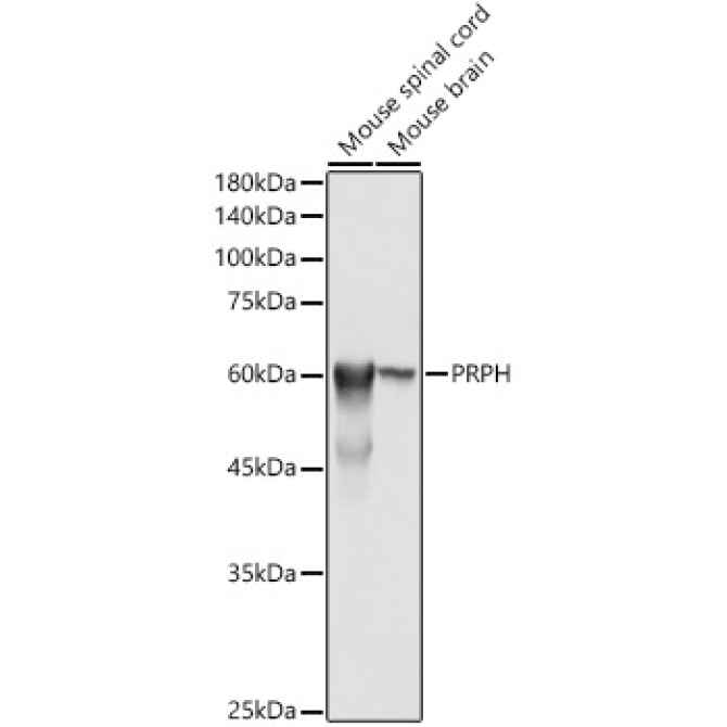 PRPH Rabbit Polyclonal Antibody