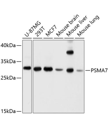 PSMA7 Rabbit Polyclonal Antibody