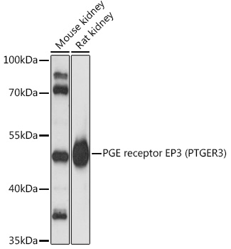 PGE receptor EP3 (PTGER3) Rabbit Polyclonal Antibody