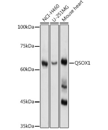 QSOX1 Rabbit Polyclonal Antibody
