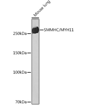 SMMHC/MYH11 Rabbit Monoclonal Antibody