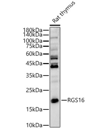 RGS16 Rabbit Polyclonal Antibody