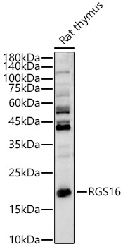 RGS16 Rabbit Polyclonal Antibody