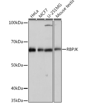 RBPJK Rabbit Monoclonal Antibody