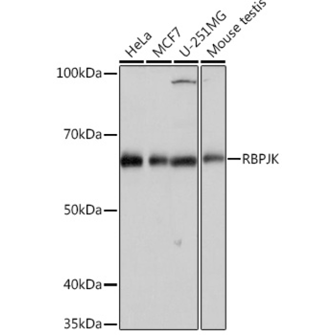 RBPJK Rabbit Monoclonal Antibody