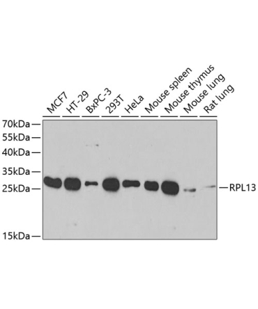RPL13 Rabbit Polyclonal Antibody