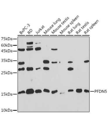PFDN5 Rabbit Monoclonal Antibody