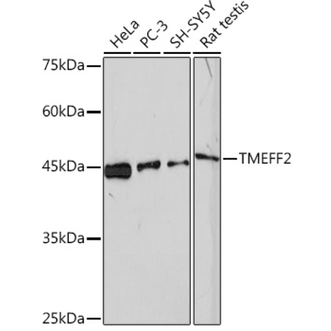 TMEFF2 Rabbit Monoclonal Antibody