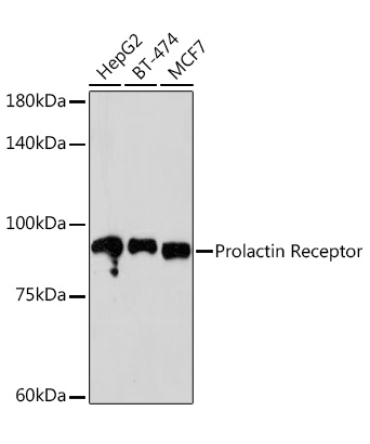 Prolactin Receptor Rabbit Monoclonal Antibody