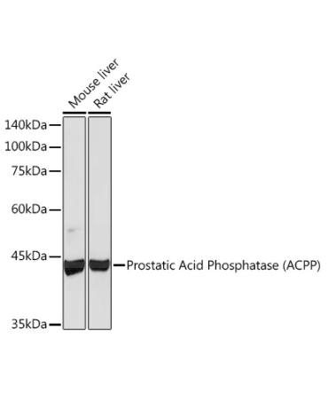 Prostatic Acid Phosphatase (ACPP) Rabbit Monoclonal Antibody