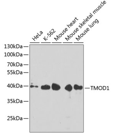 TMOD1 Rabbit Polyclonal Antibody