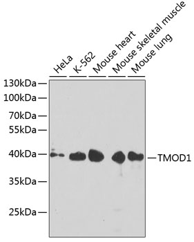 TMOD1 Rabbit Polyclonal Antibody
