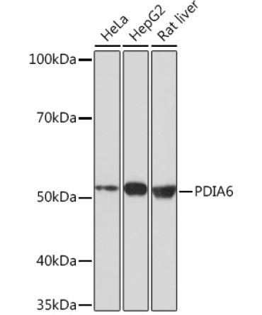 PDIA6 Rabbit Monoclonal Antibody