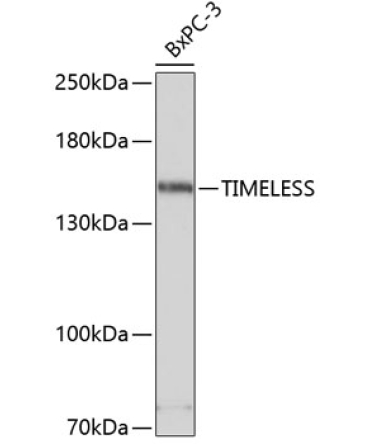 TIMELESS Rabbit Polyclonal Antibody