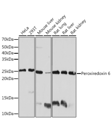 Peroxiredoxin 6 Rabbit Monoclonal Antibody