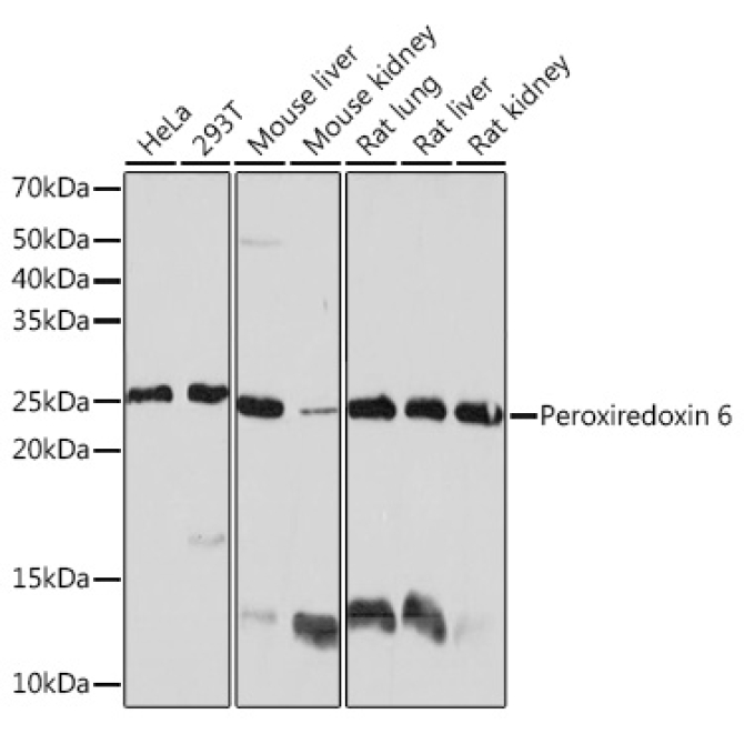 Peroxiredoxin 6 Rabbit Monoclonal Antibody