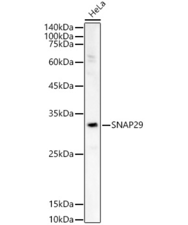 SNAP29 Rabbit Polyclonal Antibody