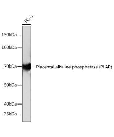 Placental alkaline phosphatase (PLAP) Rabbit Monoclonal Antibody