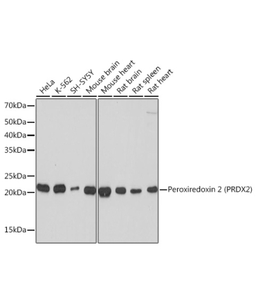 Peroxiredoxin 2 (PRDX2) Rabbit Monoclonal Antibody