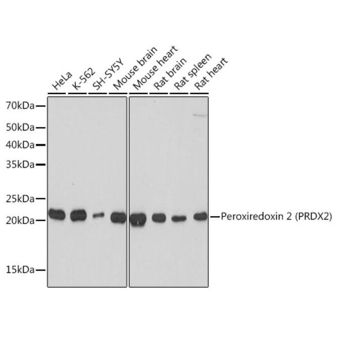 Peroxiredoxin 2 (PRDX2) Rabbit Monoclonal Antibody
