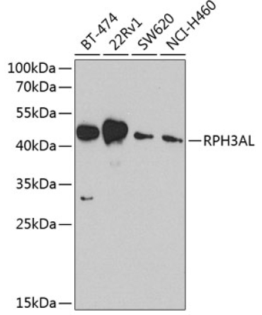 RPH3AL Rabbit Polyclonal Antibody