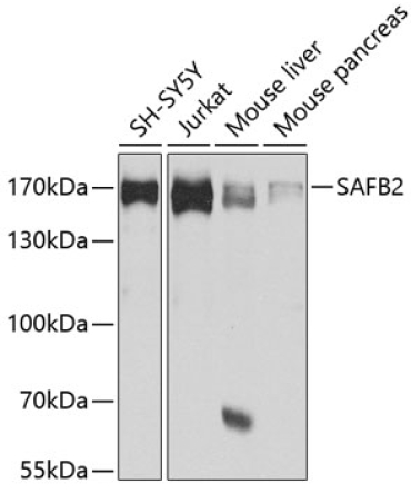 SAFB2 Rabbit Polyclonal Antibody