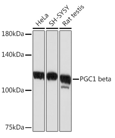 PGC1 beta Rabbit Monoclonal Antibody