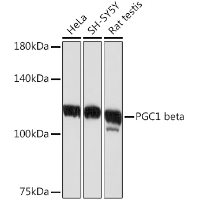 PGC1 beta Rabbit Monoclonal Antibody