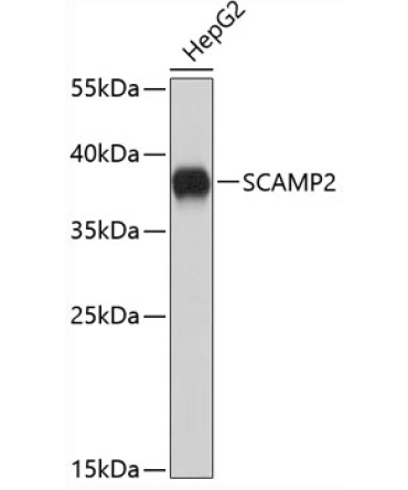 SCAMP2 Rabbit Polyclonal Antibody