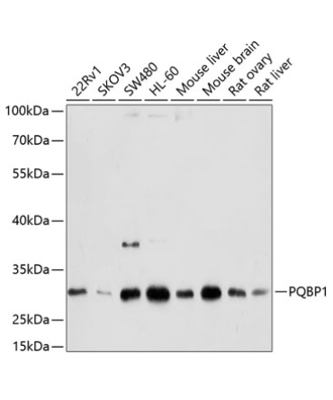 PQBP1 Rabbit Polyclonal Antibody