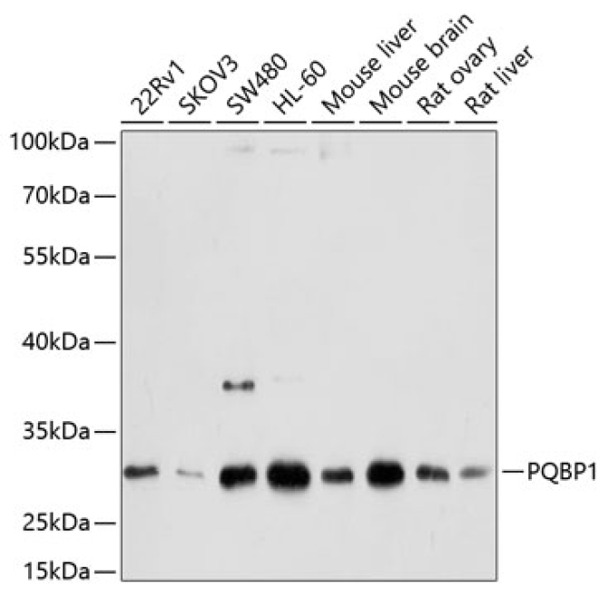 PQBP1 Rabbit Polyclonal Antibody