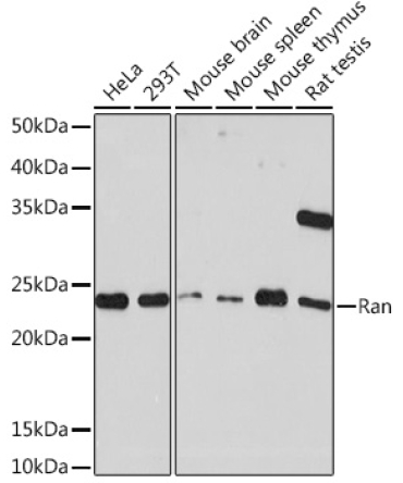Ran Rabbit Monoclonal Antibody